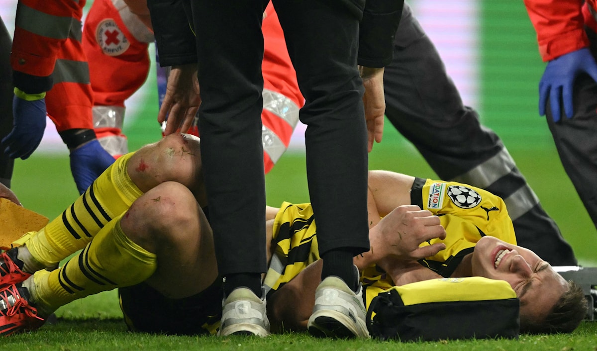 أصيب قلب دفاع فريق دورتموند نيكو شلوتربيك بتمزّق في رباط الكاحل (أ ف ب)