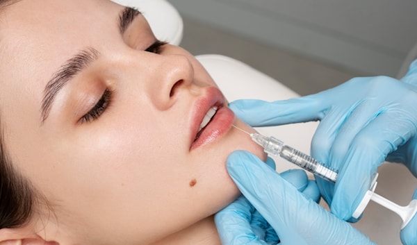 حقن الـ Bio Filler تقنية قديمة يعاد تسويقها بأسماء مختلفة.