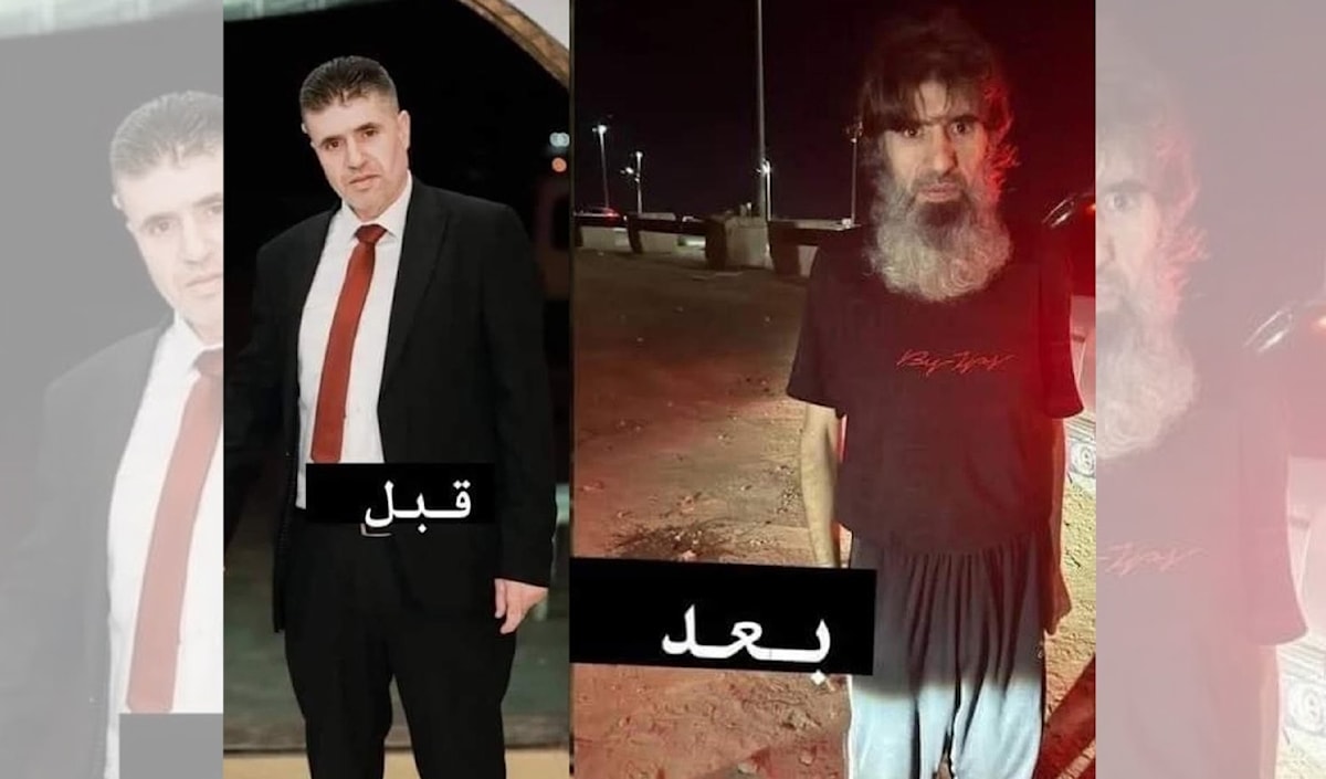 صورة الأسير المحرّر محمّد أيّوب الرجابي هي التعبير الأبلغ عن التجويع كأسلوب إماتة