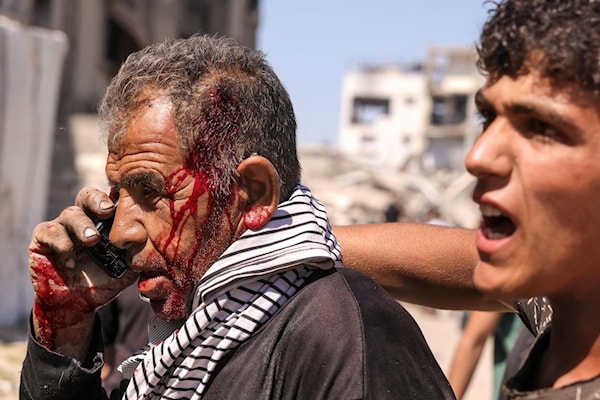 فلسطيني يتحدّث على الهاتف بعد إصابته في غارة لمسيّرة إسرائيلية في جباليا (أ ف ب)