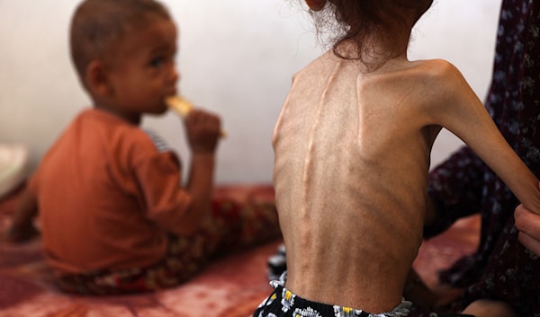 نفاد الحطب يفاقم معاناة المواطنين في قطاع غزة (فرانس برس)