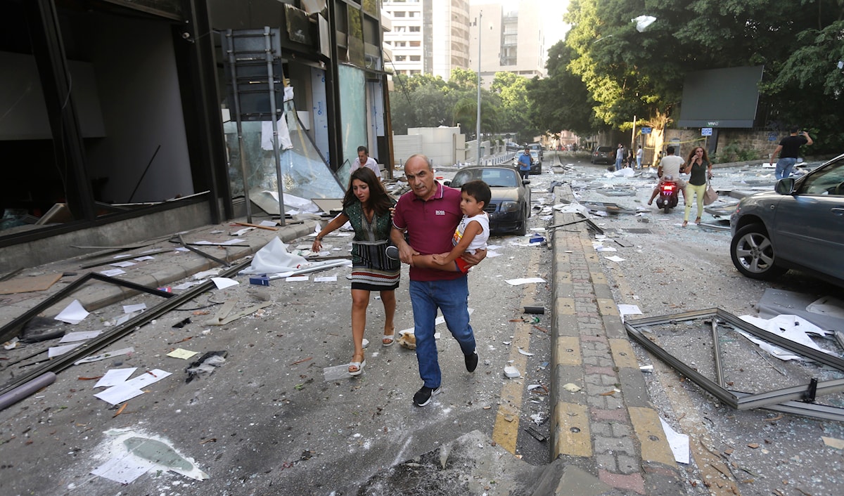 خلف انفجار مرفأ بيروت مئات من الجرحى وترك فيهم ندوباً لا تُشفى (الأخبار)