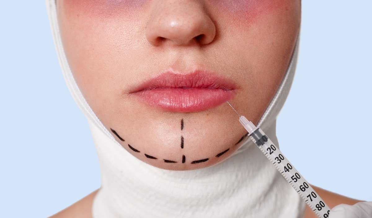 المتابعة قبل العملية وبعدها ضرورية لضمان سلامة المريض ونجاح الإجراء