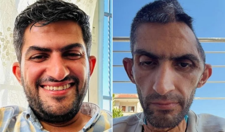 جمجمتان ووجع واحد