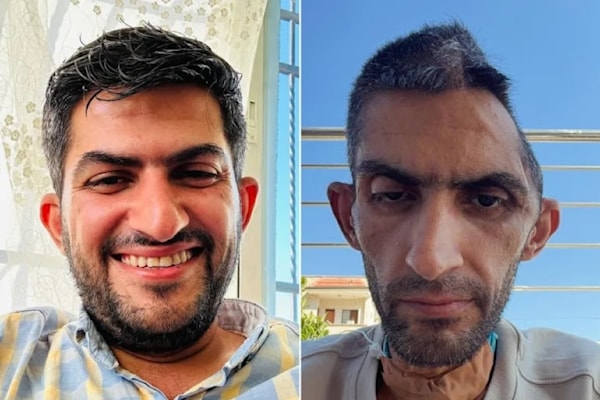 جمجمتان ووجع واحد